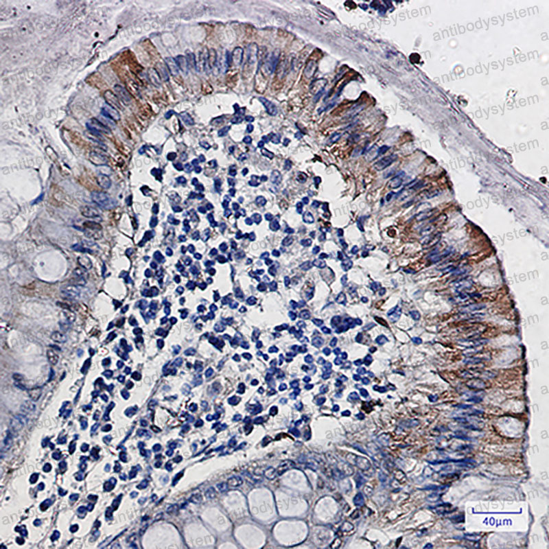 Anti-CDA Antibody (R1U52)
