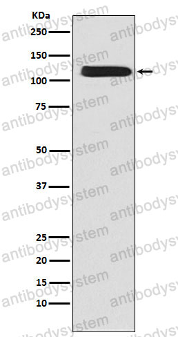 Anti-SLC8A1 Antibody (R1U53)