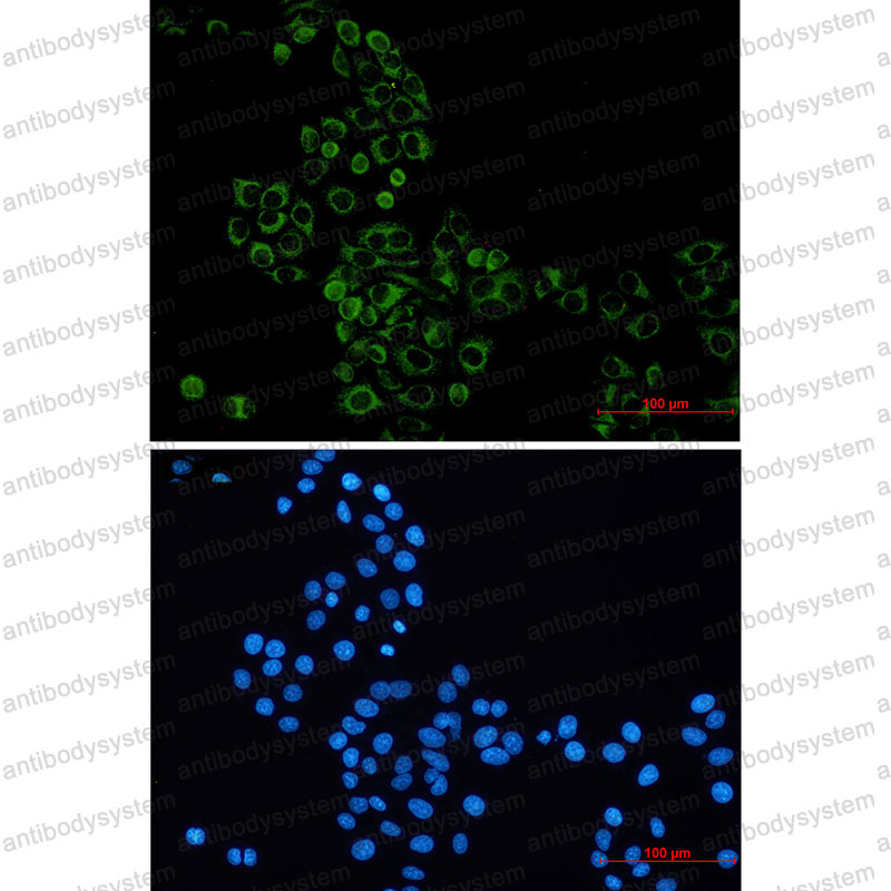 Anti-GBP1 Antibody (R1U55)