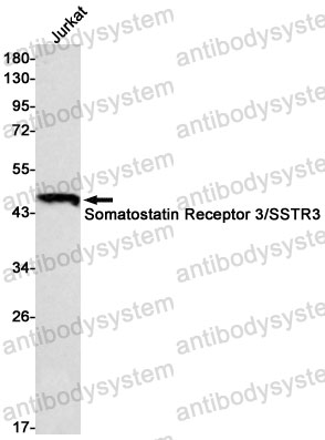Anti-SSTR3 Antibody (R1U56)
