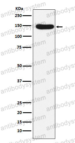 Anti-DSG3 Antibody (R1U57)