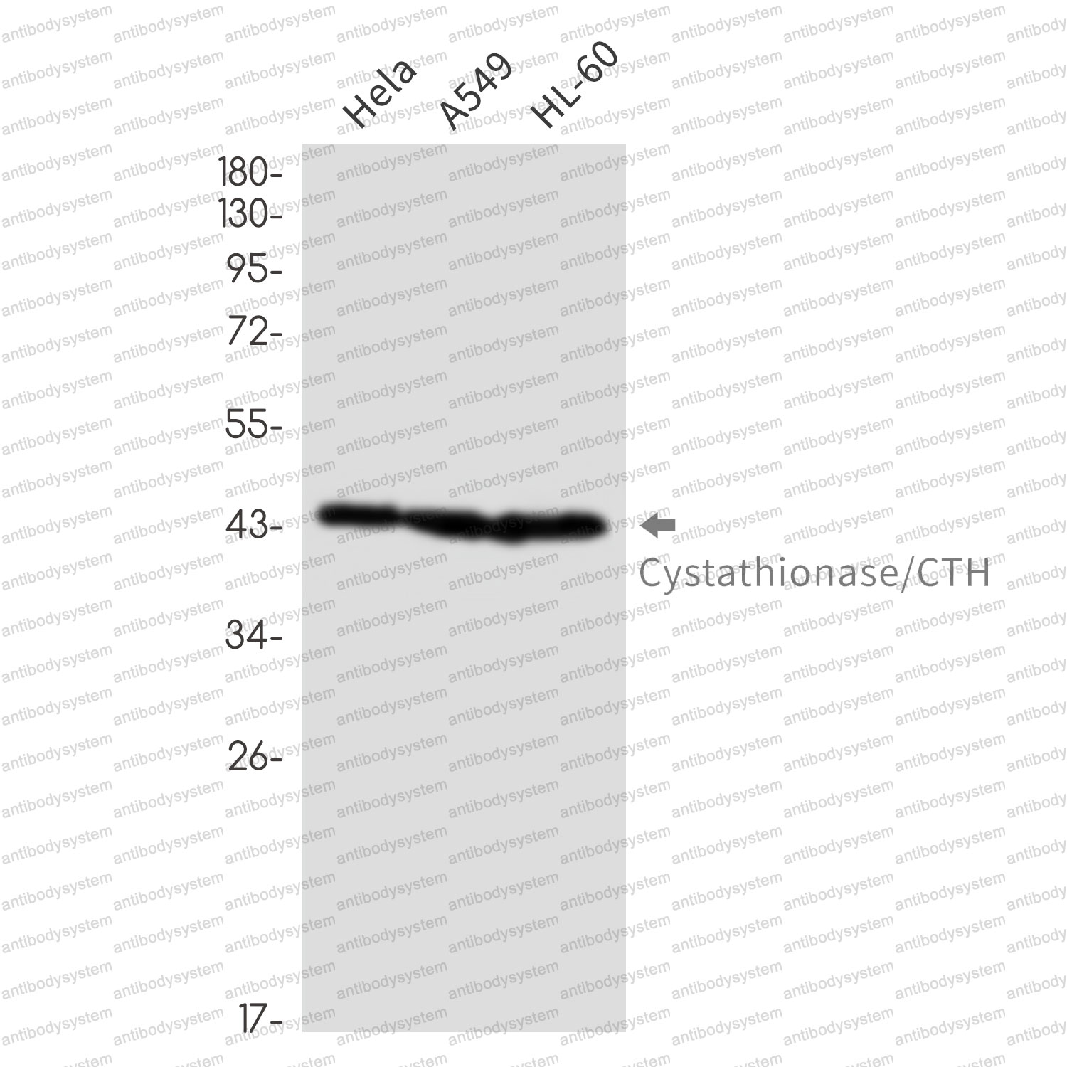 Anti-CTH Antibody (R1U59)