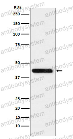 Anti-CTH Antibody (R1U58)
