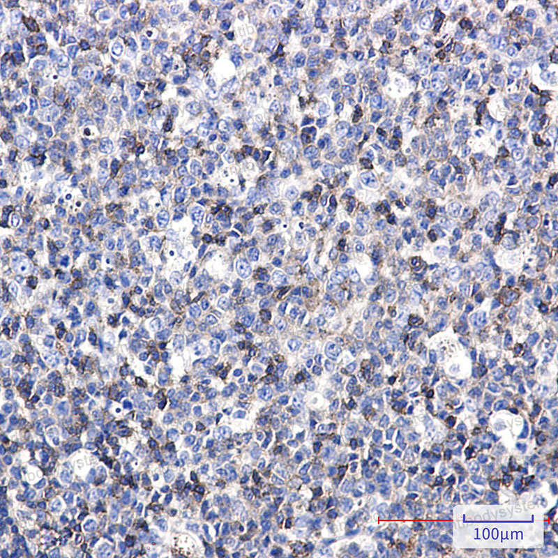 Anti-CD50/ICAM3 Antibody (R1U60)