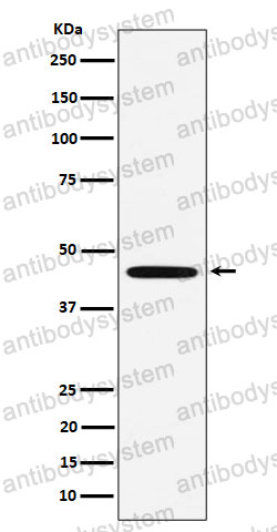 Anti-MC5R Antibody (R1U61)