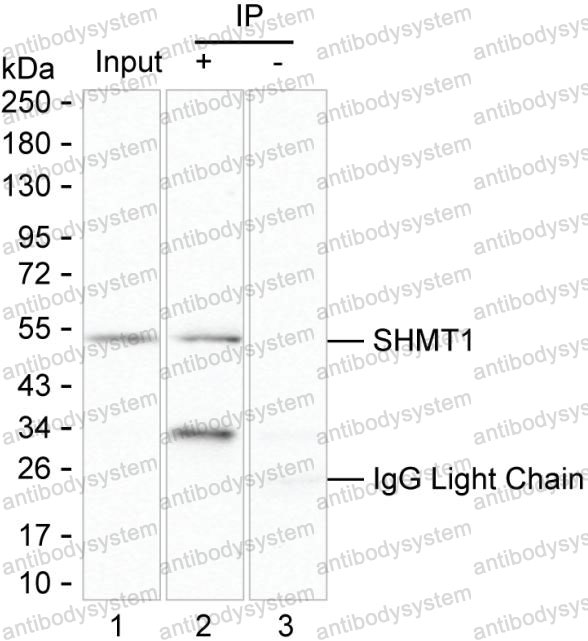 Immunoprecipitation for Anti-SHMT1 Antibody (R3J57) ?>