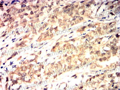 Immunohistochemical for Anti-HSPA4/HSP70 Antibody (R3J61) ?>