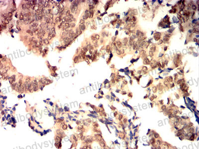 Immunohistochemical for Anti-HSPA4/HSP70 Antibody (R3J61) ?>