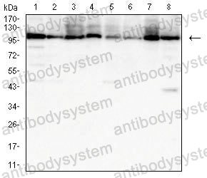 Western blot for Anti-HSPA4/HSP70 Antibody (R3J61) ?>