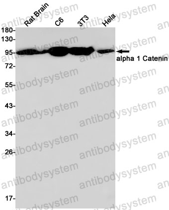 Western blot for Anti-CTNNA1 Antibody (R1U84) ?>