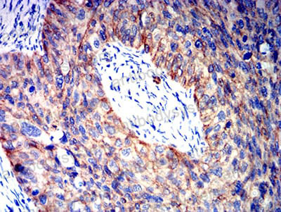 Immunohistochemical for Anti-CTNNB1 Antibody (R3J66) ?>