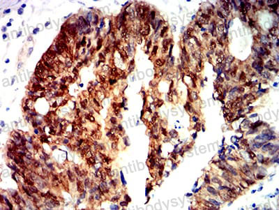 Immunohistochemical for Anti-CTNNB1 Antibody (R3J66) ?>