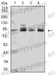 Western blot for Anti-CTNNB1 Antibody (R3J66) ?>