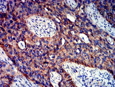 Immunohistochemical for Anti-CTNNB1 Antibody (R3J67) ?>