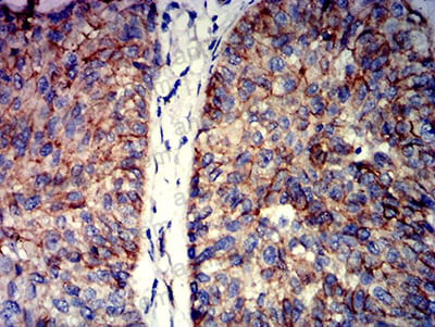 Immunohistochemical for Anti-CTNNB1 Antibody (R3J67) ?>