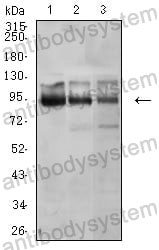 Western blot for Anti-CTNNB1 Antibody (R3J67) ?>