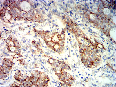 Immunohistochemical for Anti-CTNNB1 Antibody (R3J68) ?>