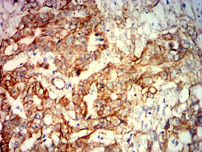 Immunohistochemical for Anti-CTNNB1 Antibody (R3J68) ?>