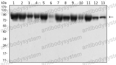 Western blot for Anti-CTNNB1 Antibody (R3J68) ?>