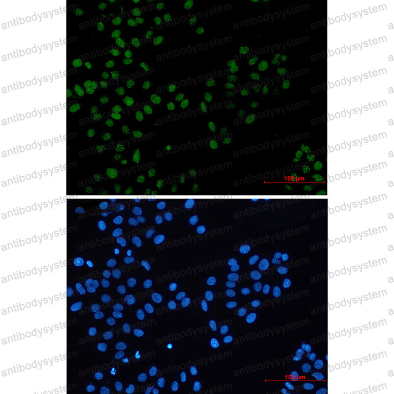 Anti-BMI1 Antibody (R1U88)