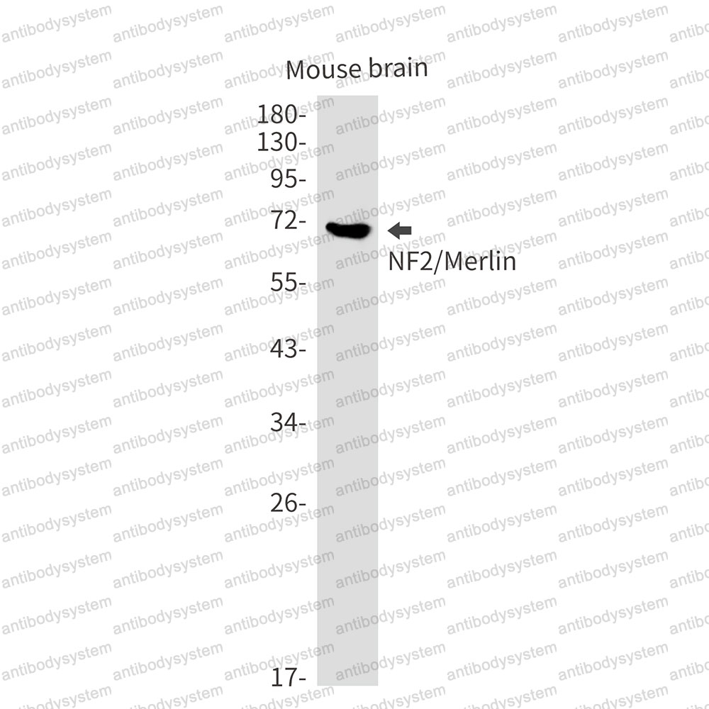 Anti-NF2 Antibody (R1U91)