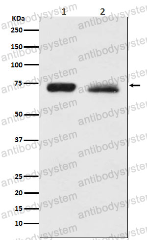 Anti-NF2/Merlin Antibody (R1U90)