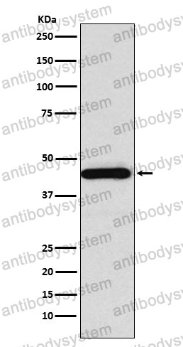 Anti-SSTR5 Antibody (R1U95)