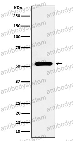 Anti-ADRA1A Antibody (R1U96)