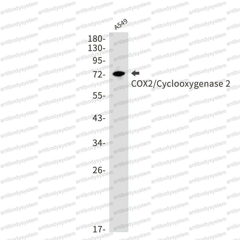 Anti-PTGS2 Antibody (R1V01)