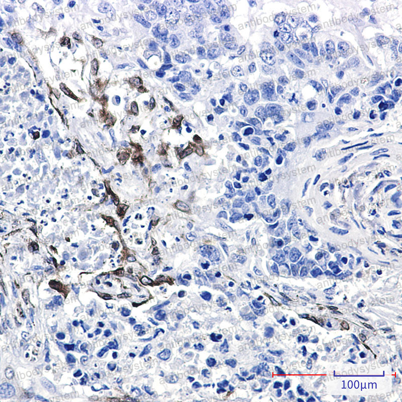 Anti-PTGS2 Antibody (R1U99)