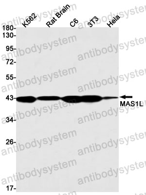 Anti-MAS1L Antibody (R1V03)