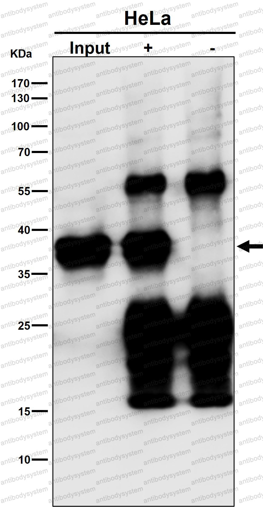Anti-MAS1L Antibody (R1V02)