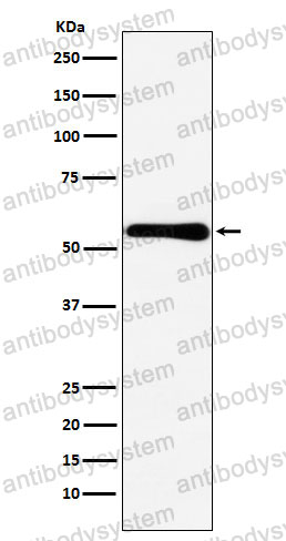 Anti-CBS Antibody (R1V05)