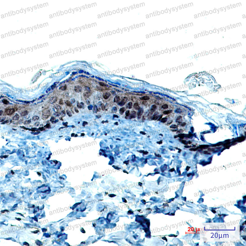 Anti-KRT9 Antibody (R1V06)