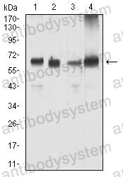 Western blot for Anti-KRT9 Antibody (R3J78) ?>