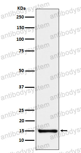Anti-SAA4 Antibody (R1V07)