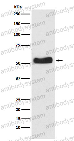 Anti-GCK Antibody (R1V08)