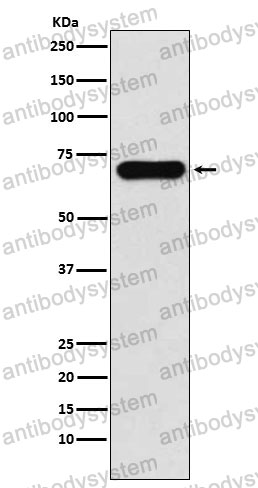 Anti-PCK1 Antibody (R1V09)