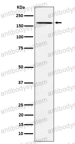 Anti-AGL Antibody (R1V11)