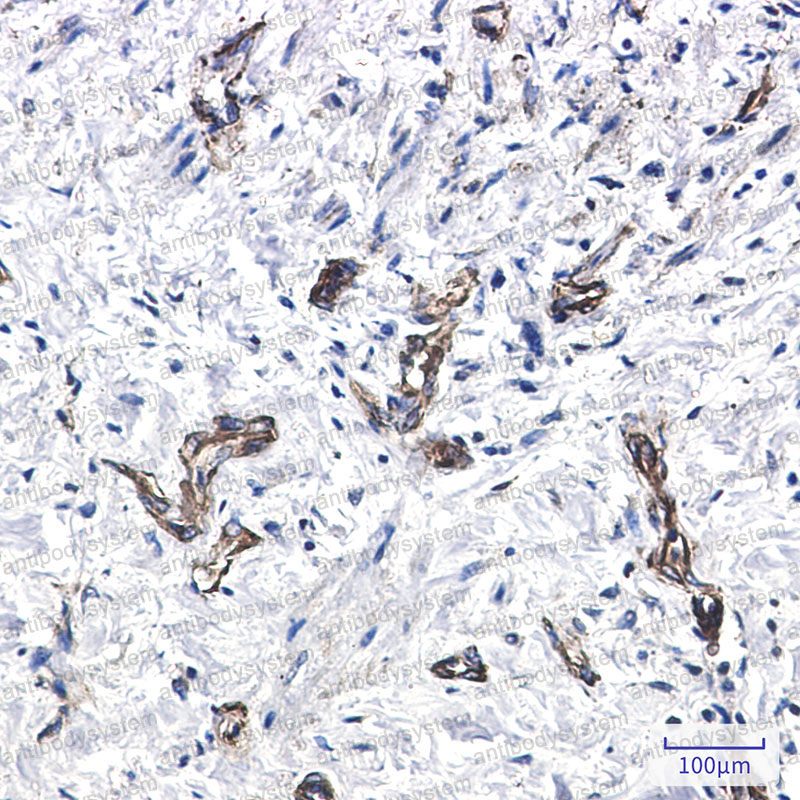 Anti-MYH9 Antibody (R1V12)