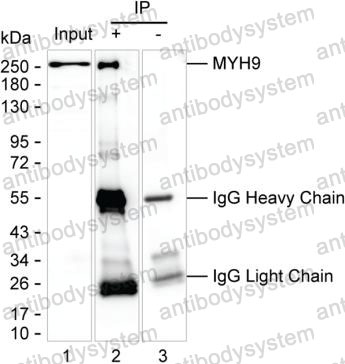 Immunoprecipitation for Anti-MYH9 Antibody (R3J79) ?>
