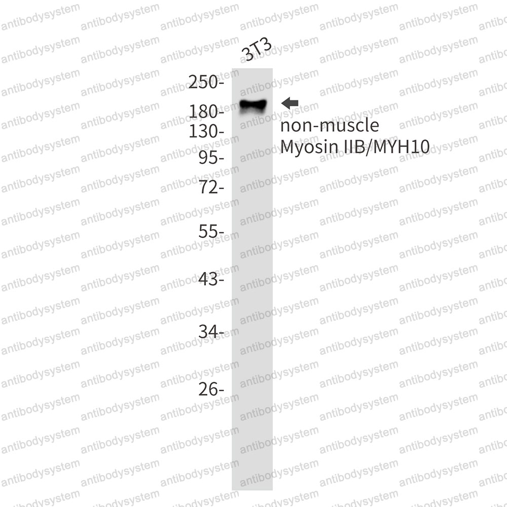 Anti-MYH10 Antibody (R1V13)
