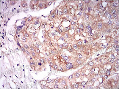 Immunohistochemical for Anti-TIE1 Antibody (R3J80) ?>