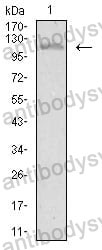 Western blot for Anti-TIE1 Antibody (R3J80) ?>
