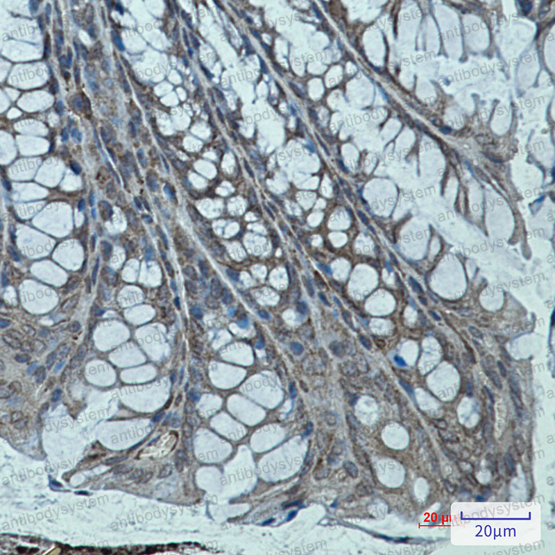 Anti-ACTN2 Antibody (R1V16)