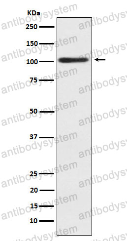 Anti-ACTN2 Antibody (R1V15)