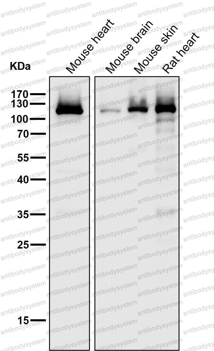 Anti-ACTN2 Antibody (R1V14)