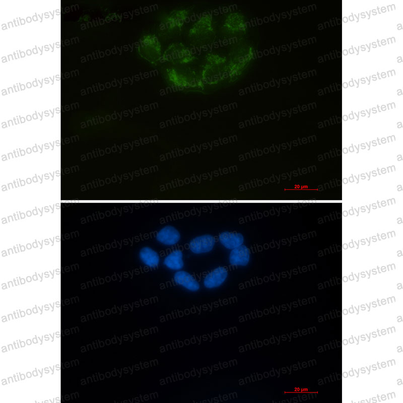 Anti-CD147/BSG Antibody (R1V18)