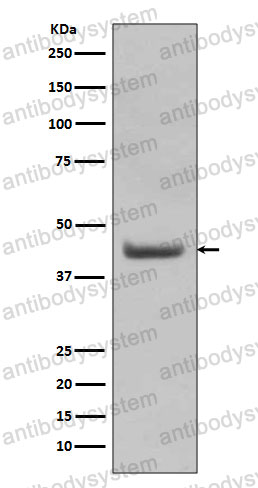 Anti-SOX18 Antibody (R1B85)