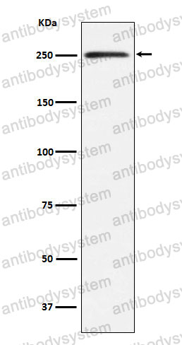 Anti-MYH11 Antibody (R1V27)